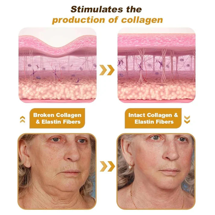 Botox Bee Venom Wrinkle Repair Ceam