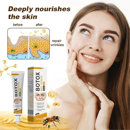 Botox Bee Venom Wrinkle Repair Ceam