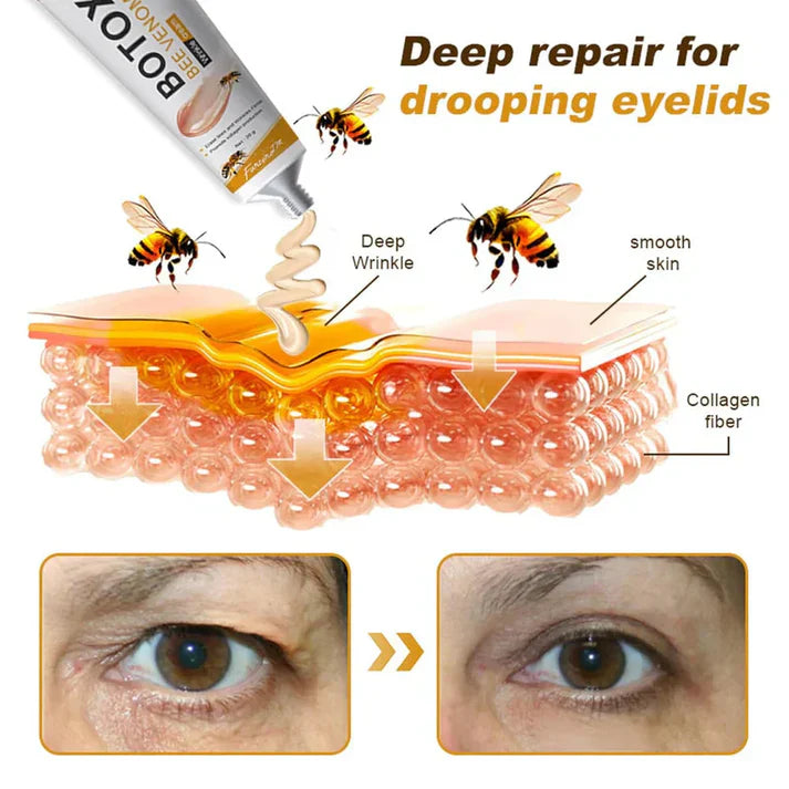 Botox Bee Venom Wrinkle Repair Ceam